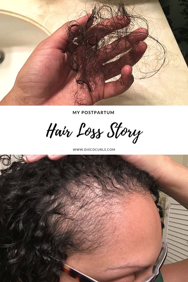 image of postpartum hair loss